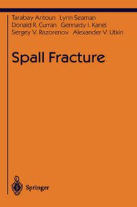 Cover image for Spall Fracture
