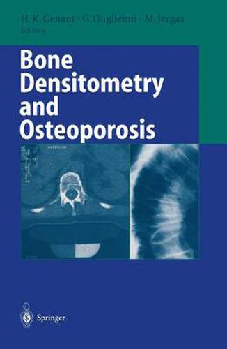 Cover image for Bone Densitometry and Osteoporosis