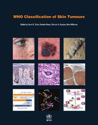 Cover image for WHO Classification of Skin Tumours: WHO Classification of Tumours, Volume 11