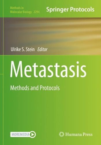 Cover image for Metastasis: Methods and Protocols