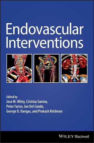 Cover image for Endovascular Interventions