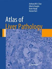 Cover image for Atlas of Liver Pathology