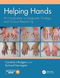Cover image for Helping Hands: An Introduction to Diagnostic Strategy and Clinical Reasoning