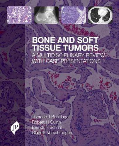 Cover image for Bone and Soft Tissue Tumors: A Multidisciplinary Review with Case Presentations