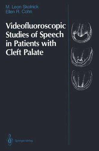 Cover image for Videofluoroscopic Studies of Speech in Patients with Cleft Palate