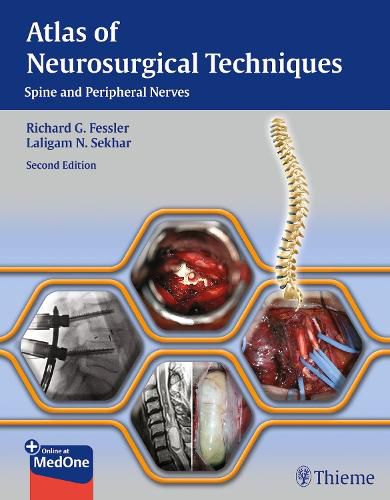 Cover image for Atlas of Neurosurgical Techniques: Spine and Peripheral Nerves