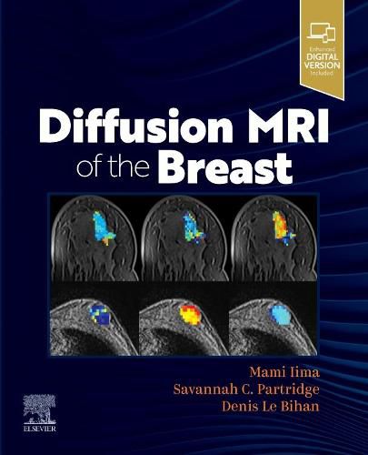 Cover image for Diffusion MRI of the Breast