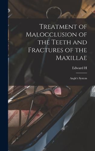 Cover image for Treatment of Malocclusion of the Teeth and Fractures of the Maxillae