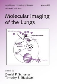 Cover image for Molecular Imaging of the Lungs