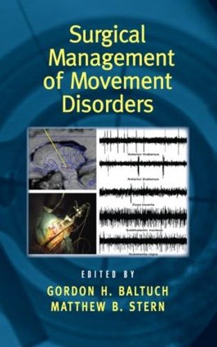 Cover image for Surgical Management of Movement Disorders