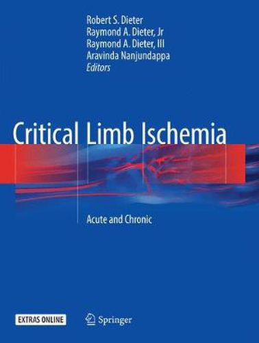 Cover image for Critical Limb Ischemia: Acute and Chronic