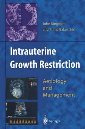 Intrauterine Growth Restriction: Aetiology and Management