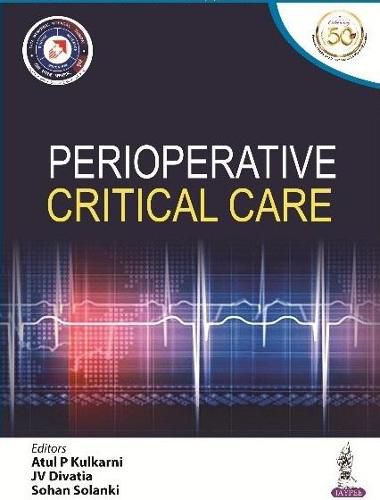 Cover image for Perioperative Critical Care