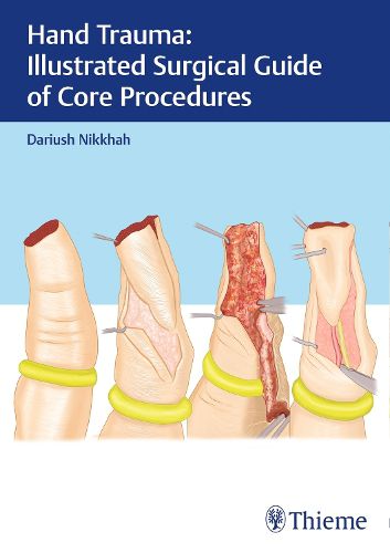 Cover image for Hand Trauma: Illustrated Surgical Guide of Core Procedures
