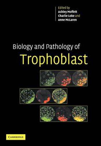 Cover image for Biology and Pathology of Trophoblast