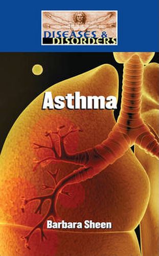 Cover image for Asthma