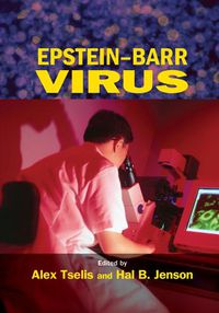 Cover image for Epstein-Barr Virus