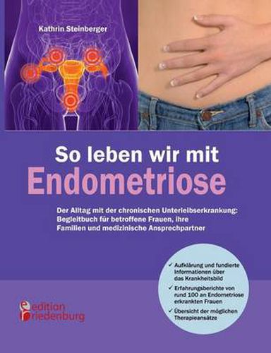 Cover image for So leben wir mit Endometriose - Der Alltag mit der chronischen Unterleibserkrankung: Begleitbuch fur betroffene Frauen, ihre Familien und medizinische Ansprechpartner