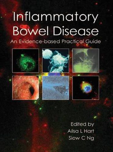 Cover image for Inflammatory Bowel Disease: An Evidence-Based Practical Guide