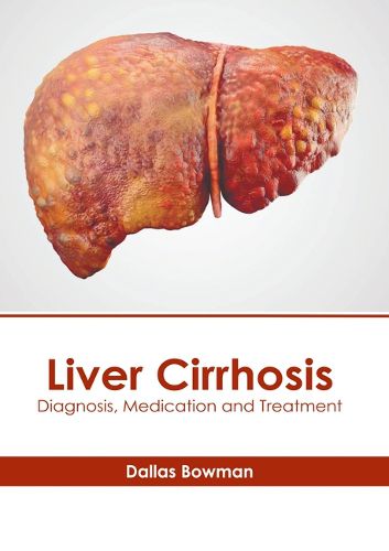 Cover image for Liver Cirrhosis: Diagnosis, Medication and Treatment