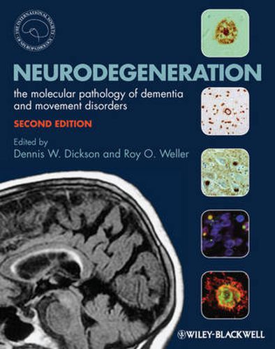 Cover image for Neurodegeneration - The Molecular Pathology of Dementia and Movement Disorders 2e