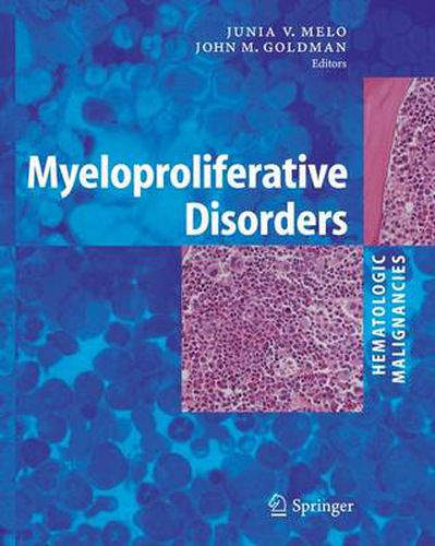 Cover image for Myeloproliferative Disorders