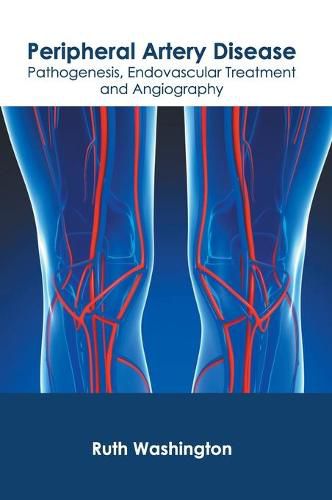 Cover image for Peripheral Artery Disease: Pathogenesis, Endovascular Treatment and Angiography