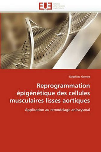 Cover image for Reprogrammation Epigenetique Des Cellules Musculaires Lisses Aortiques