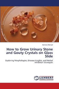 Cover image for How to Grow Urinary Stone and Gouty Crystals on Glass Slide