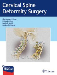 Cover image for Cervical Spine Deformity Surgery