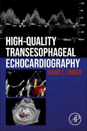 Cover image for High-Quality Transesophageal Echocardiography