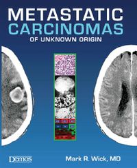 Cover image for Metastatic Carcinomas of Unknown Origin