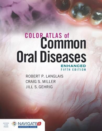 Color Atlas Of Common Oral Diseases, Enhanced Edition