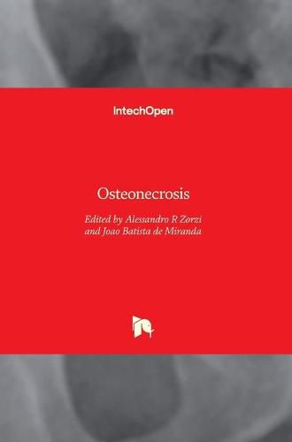 Cover image for Osteonecrosis