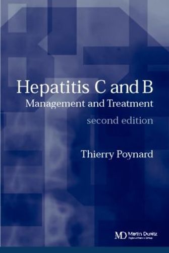 Cover image for Hepatitis B and C: Management and Treatment