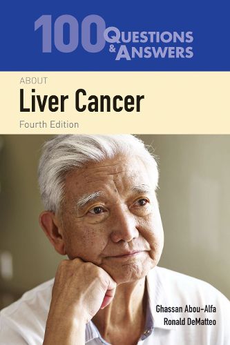 Cover image for 100 Questions  &  Answers About Liver Cancer