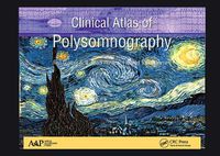 Cover image for Clinical Atlas of Polysomnography