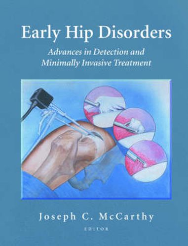 Early Hip Disorders: Advances in Detection and Minimally Invasive Treatment