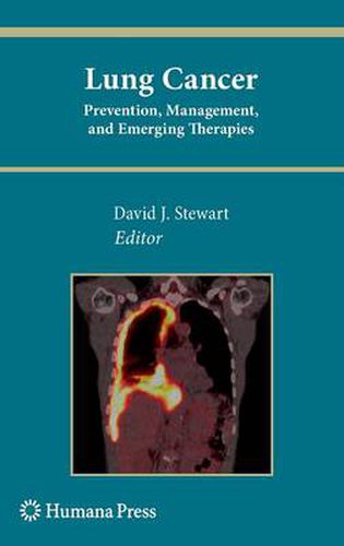 Cover image for Lung Cancer:: Prevention, Management, and Emerging Therapies