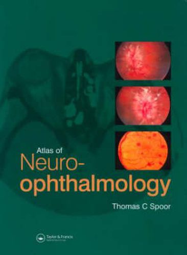 Cover image for Atlas of Neuro-ophthalmology