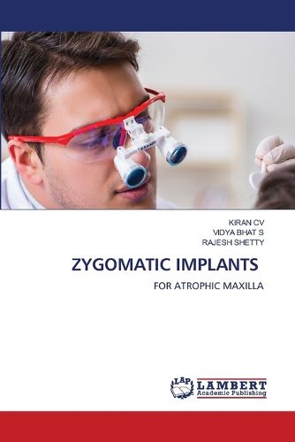 Cover image for Zygomatic Implants