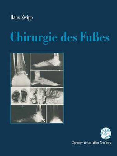 Cover image for Chirurgie des Fusses