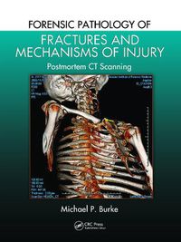 Cover image for Forensic Pathology of Fractures and Mechanisms of Injury: Postmortem CT Scanning