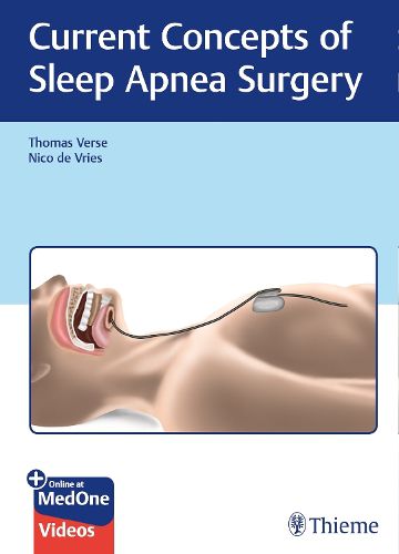 Cover image for Current Concepts of Sleep Apnea Surgery