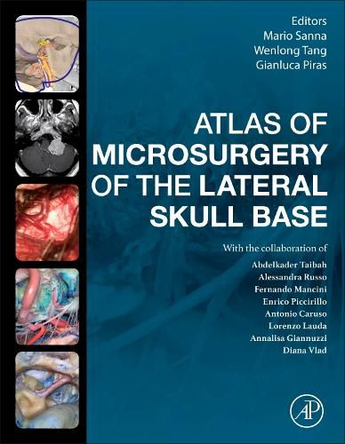 Cover image for Atlas of Microsurgery of the Lateral Skull Base