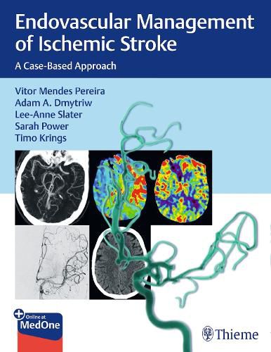 Cover image for Endovascular Management of Ischemic Stroke: A Case-Based Approach