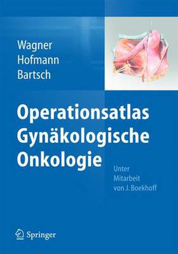 Cover image for Operationsatlas Gynakologische Onkologie