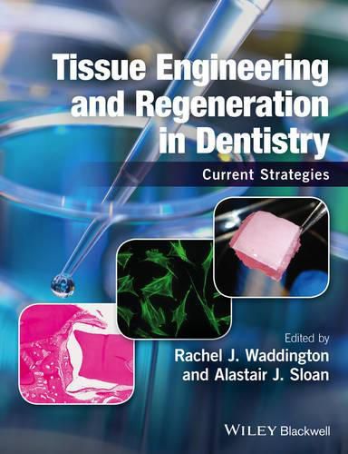 Cover image for Tissue Engineering and Regeneration in Dentistry: Current Strategies