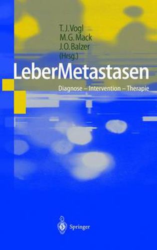 Cover image for LeberMetastasen: Diagnose - Intervention - Therapie