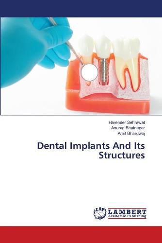 Cover image for Dental Implants And Its Structures